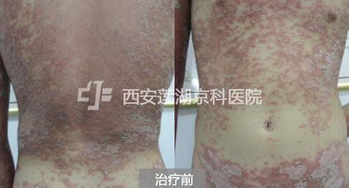 �κ������м�� �����ٻظ�ĸ����