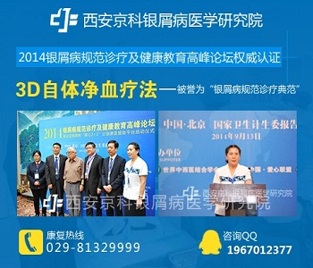 咸阳市治牛皮癣