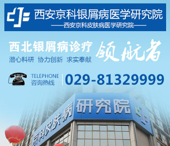 咸阳哪里看银屑病最好