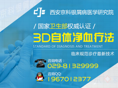 咸阳医院治牛皮癣